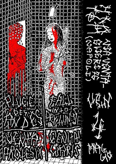 Plucié Des Andes, Genital Warts & Fall Into Dry Lungs @ 76A, Naples, ITALY